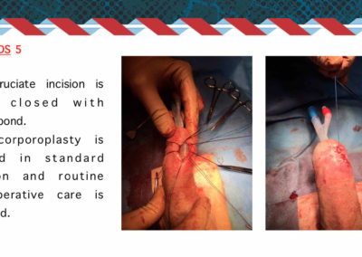 Procedure protesi peniena⚕️Gabriele Antonini MD PhD - Uro-Andrological mini Invasive Surgery - Medical office: Rome, 00185 - Via Niccolò Machiavelli 47 – Phone (+39) 06 64821375