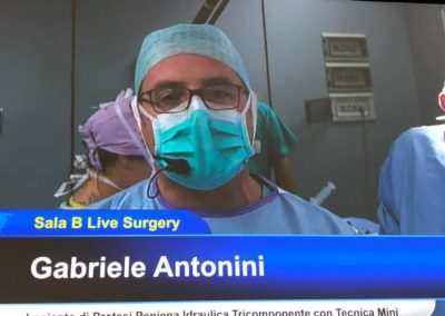 Tumore della Prostata - Dalla malattia alla riabilitazione sessuale - Antonini-Gallucci - 01
