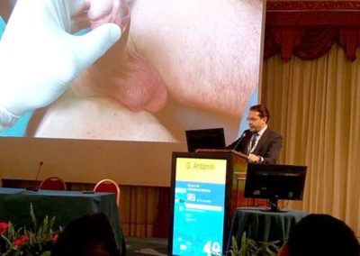 XXXII Congresso Nazionale SIA di Stresa_dott_gabriele_antonini