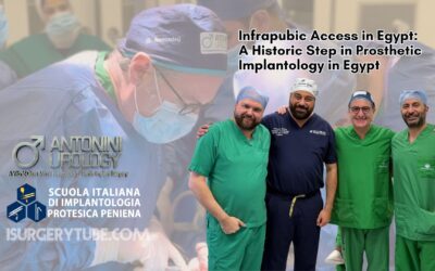 Acesso Infrapúbico no Egito
