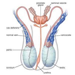 grafica_3D_varicocele-antoniniurology-2021
